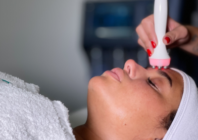 foto di esempio trattamento estetica avanzata a napoli - mama beauty club soccavo