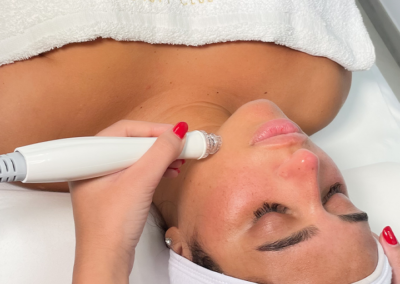foto di un trattamento con hydra touch h2 - istituto di medicina estetica avanzata napoli soccavo mama beauty club