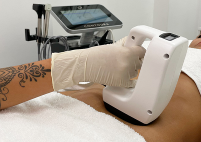 trattamento medicina estetica avanzata napoli - mama beauty club